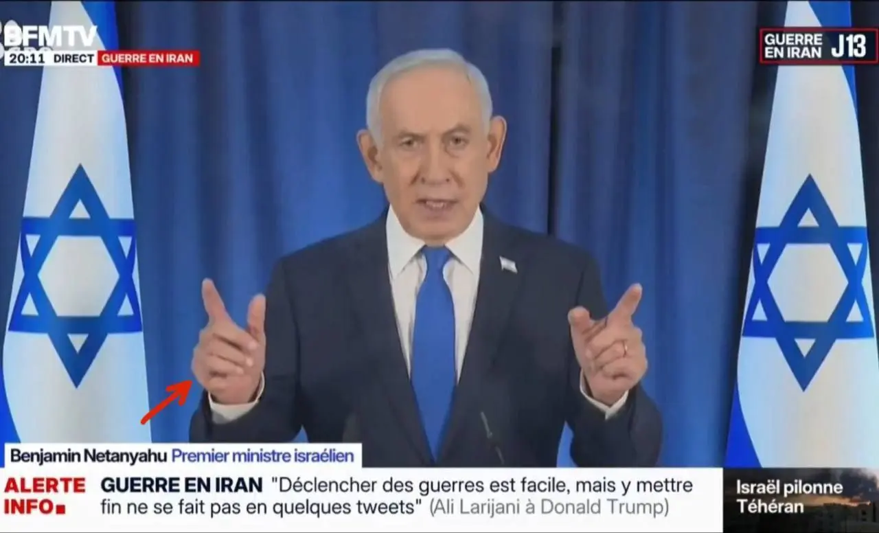 انگشت ششم نتانیاهو خبرساز شد